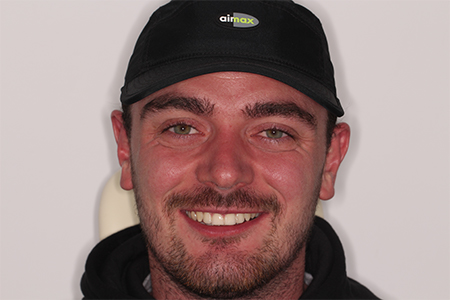 After Invisalign Treatment Reading Smiles After Invisalign Treatment Reading Smiles