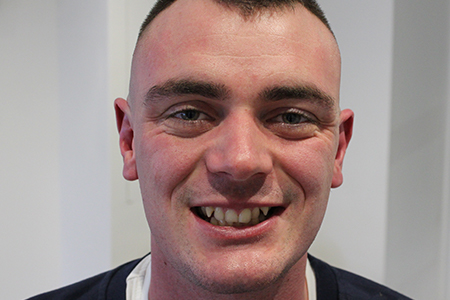 Before Invisalign Treatment Reading Smiles Before Invisalign Treatment Reading Smiles