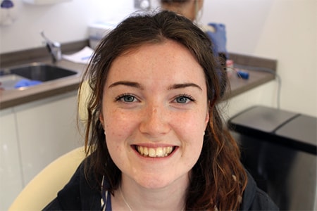 Before Invisalign Treatment Reading Smiles Before Invisalign Treatment Reading Smiles