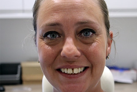 Before Invisalign Treatment Reading Smiles Before Invisalign Treatment Reading Smiles