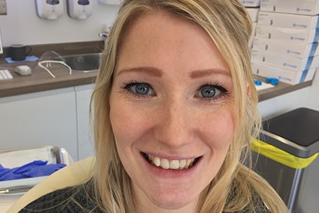 Before Invisalign Treatment Reading Smiles Before Invisalign Treatment Reading Smiles