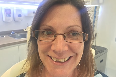 Before Invisalign Treatment Reading Smiles Before Invisalign Treatment Reading Smiles