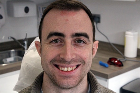 Before Invisalign Treatment Reading Smiles Before Invisalign Treatment Reading Smiles