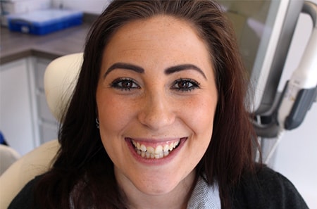 Before Invisalign Treatment Reading Smiles Before Invisalign Treatment Reading Smiles